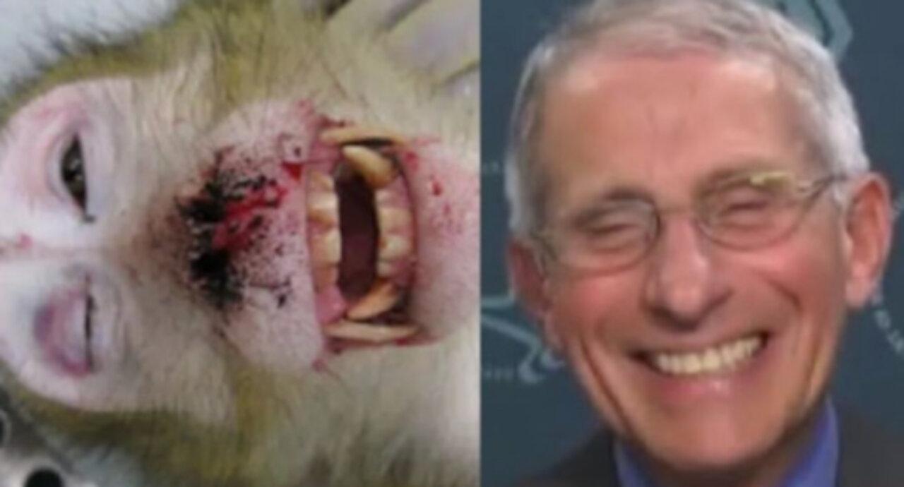 Fauci Funding ‘Maximum Pain’ Experiments On Monkeys