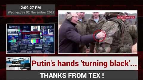 Putin's hands 'turning black'...