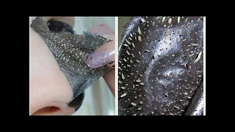 DIY Blackhead Remover Peel Off Mask REMOVES EVERYTHING Easy (