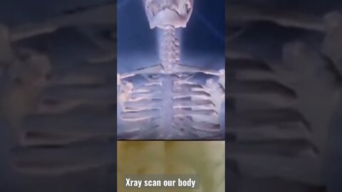 X ray #views in #body this #sky #shortvideo suting on n HD 720 not iPhone o tuch and like subscribe