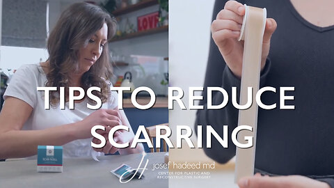 Tips for Reducing Scarring After Surgery