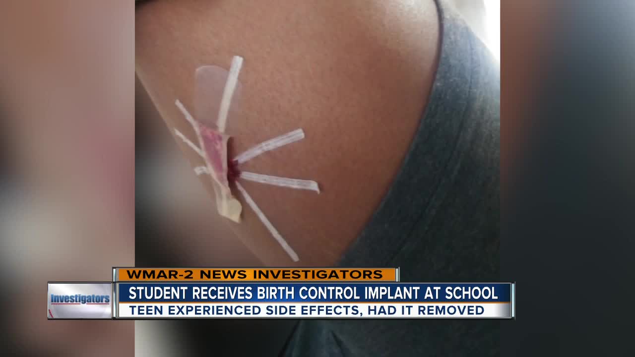 Student receives birth control implant at school