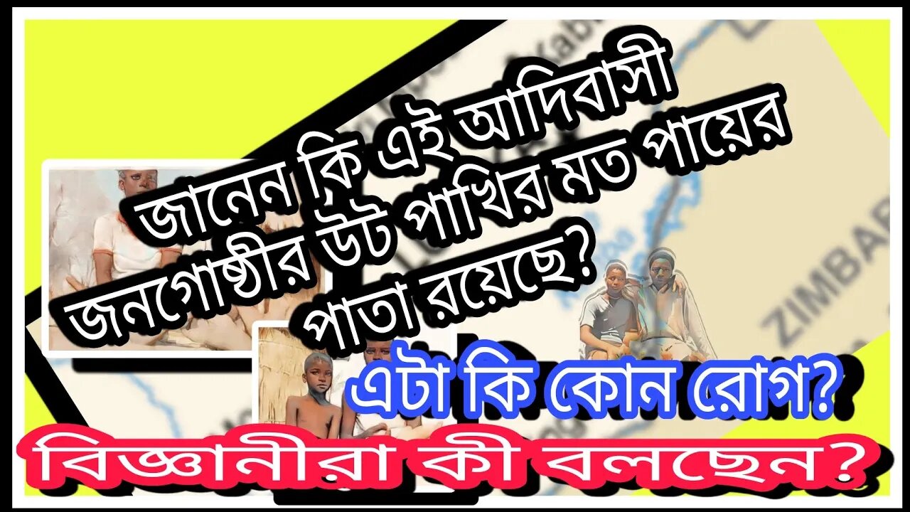 ll কোন আদিম জনগোষ্ঠীর উটপাখির মত পায়ের পাতা আছে? এটা কি কোন বিরল রোগ? বিজ্ঞানীরা কী বলছেন? দেখুন ll