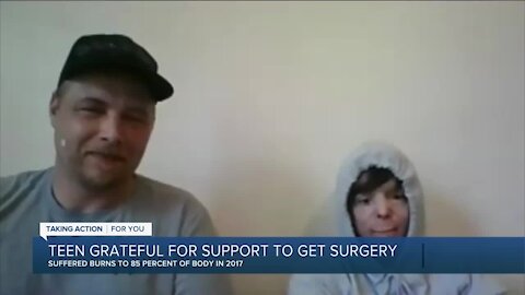 Teen grateful for support to get surgery