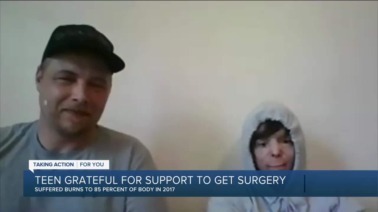 Teen grateful for support to get surgery