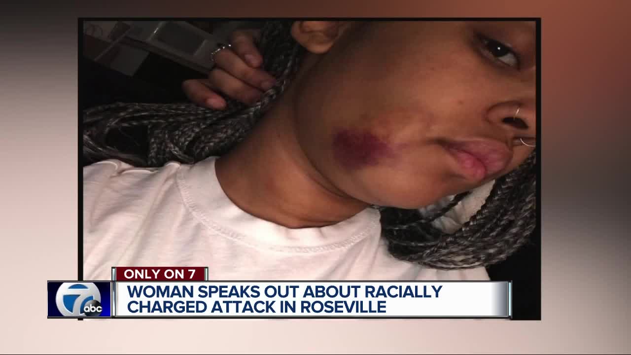 Metro Detroit woman beaten in parking lot, she says because she's black