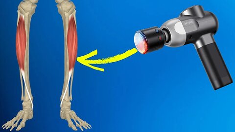 How to Use a Massage Gun for Shin Splints: Warm-Up Tips for Pain Relief