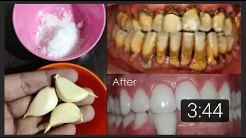 Teeth whitening at home in 3 minutes || How to naturally whiten your yellow teeth || 100% effective