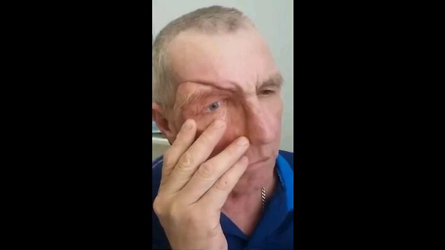 Removing part of his face