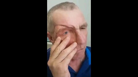 Removing part of his face