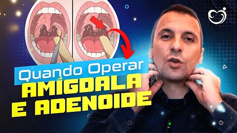 QUANDO É NECESSÁRIO OPERAR A AMÍGDALA E ADENOIDE?