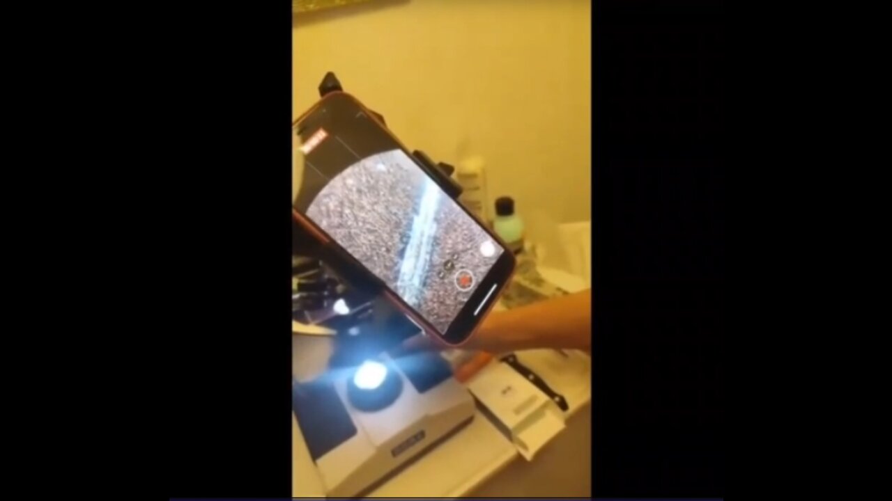 Presence of graphene in a drop of blood from a vaccinated person