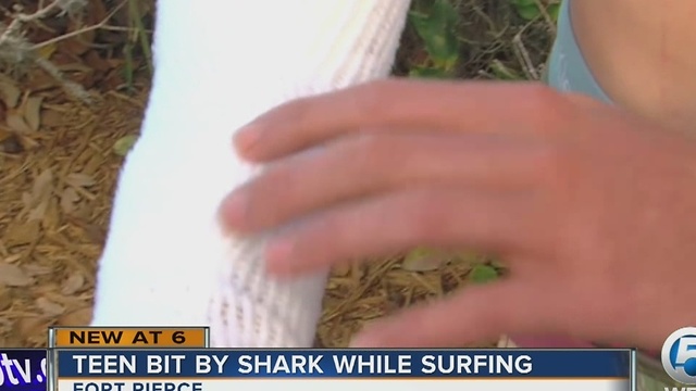 Teen bit by shark while surfing