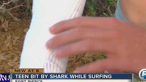 Teen bit by shark while surfing