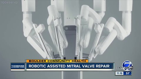 Robotic Assisted Mitral Valve Repair