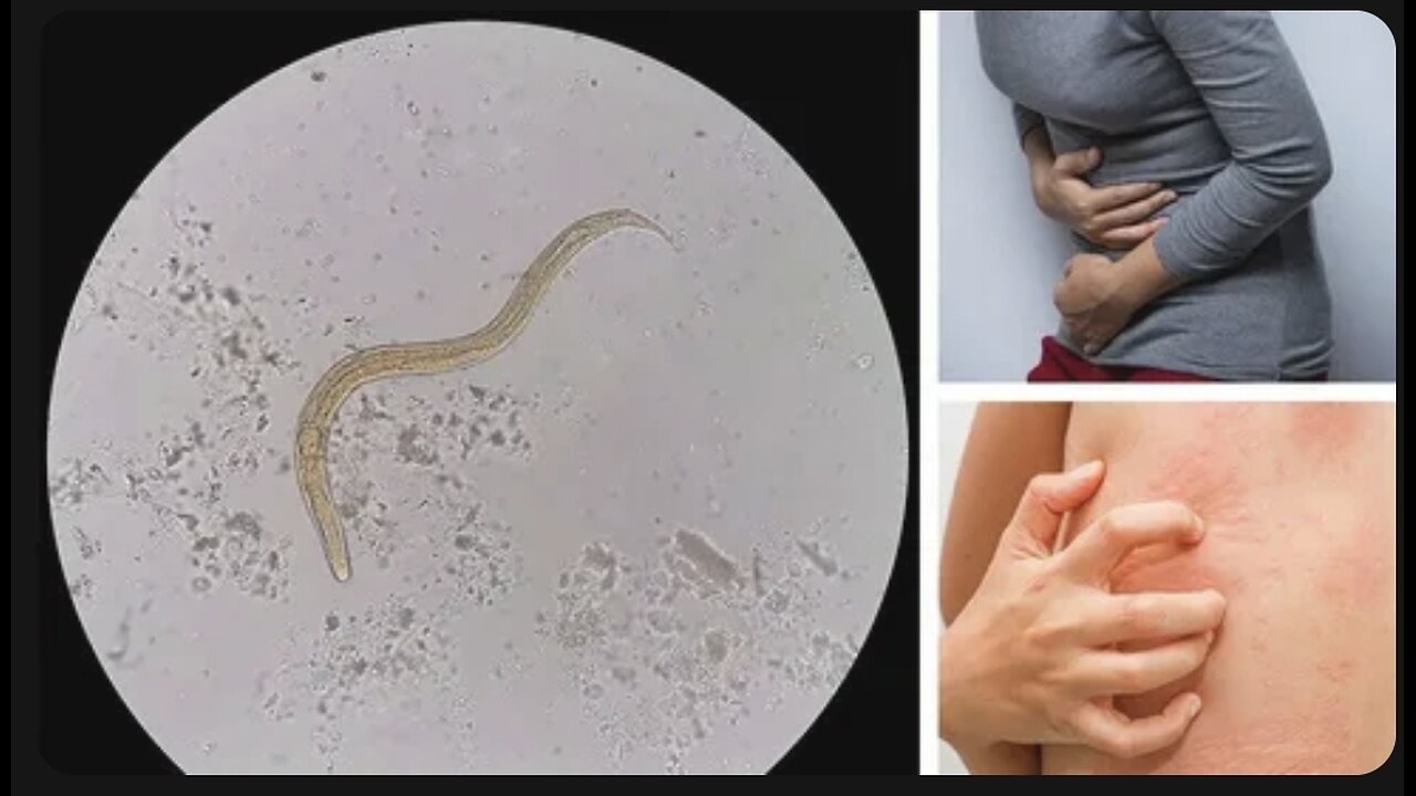 Dr. Tom Cowan on the role of parasites within the body.