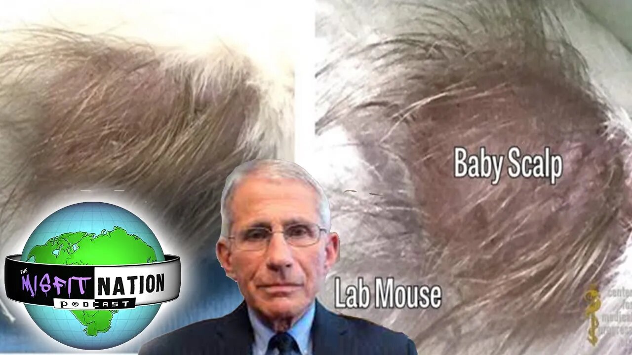 DISTURBING: Dr. Fauci Linked to University Experimenting on Aborted Baby Parts