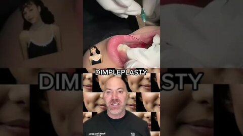 Fake Dimple Surgery?! 😱 #shorts