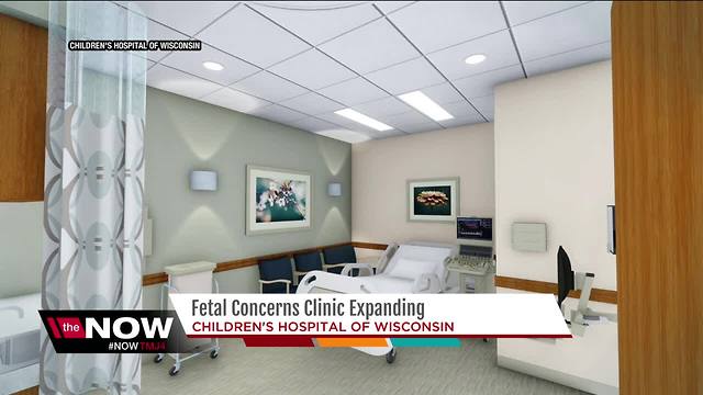 Children's Hospital of Wisconsin expanding Fetal Care Center