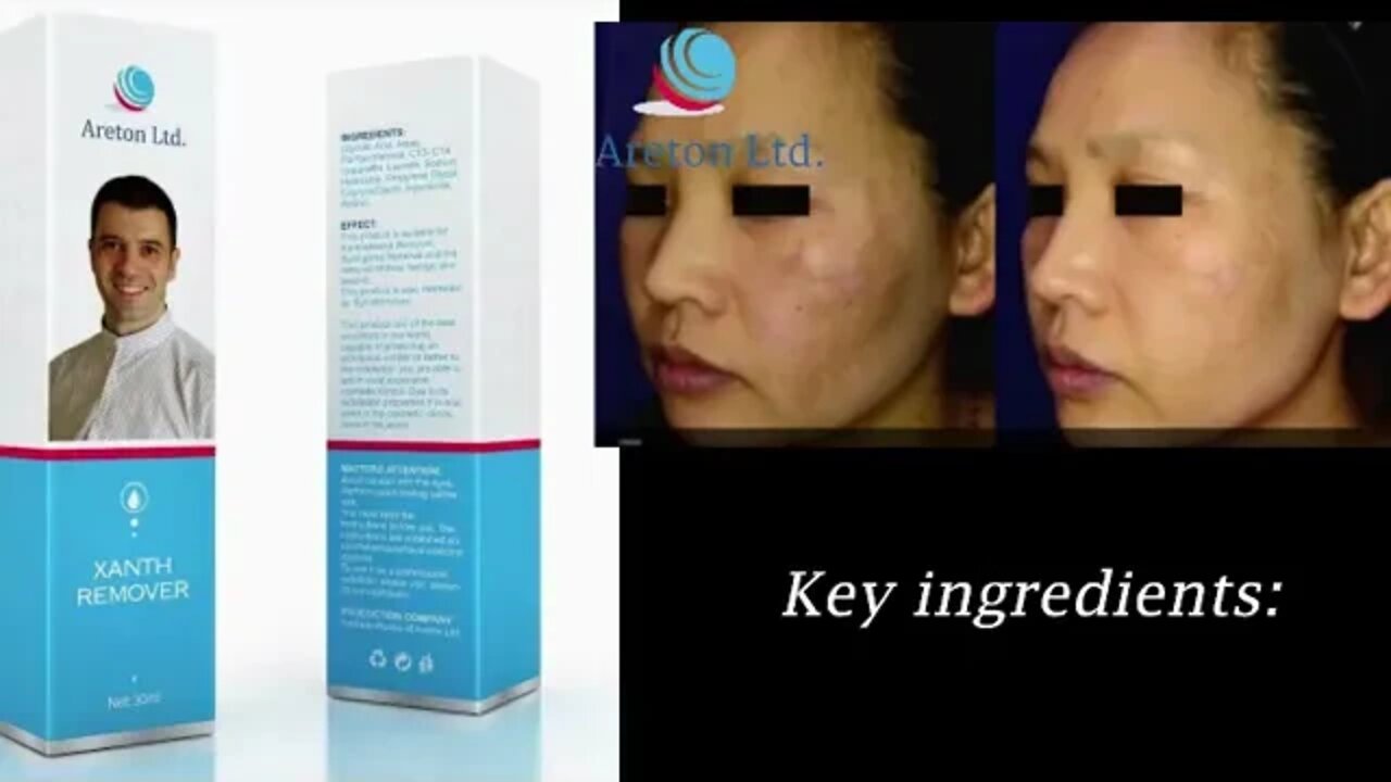 Dark Spots & Dark Circles Remover using Glycolic Acid Peel XanthRemover