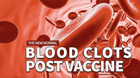 BLOOD CLOTS: THE NEW NORMAL