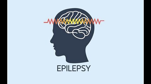 Epilepsy