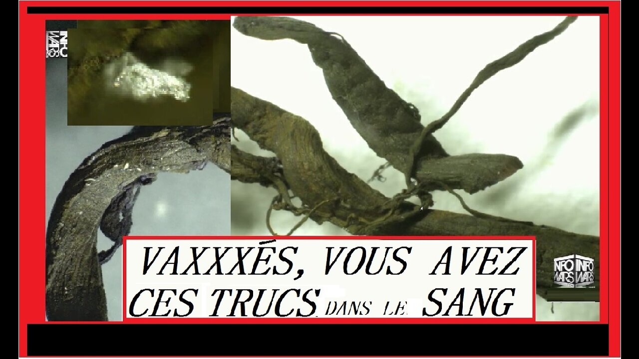 VAXXXÉS, VOUS AVEZ CES TRUCS DANS LE SANG ??