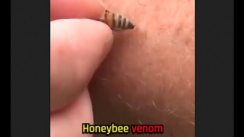 Honey Bee venom kills breast cancer cells & leaves normal healthy cells unharmed - HaloHealthth