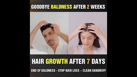 How to stop hair fall | Hair growth in 7 days | How to get good hair growth | Stop Hair Loss