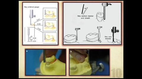 Prosthodontics L4 part1 (Dental Surveyor And Surveying)