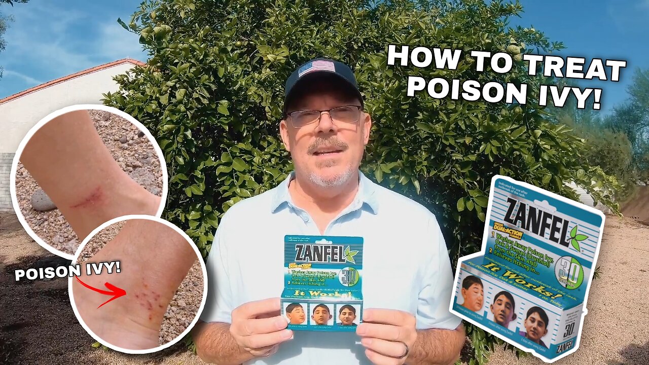 How to Treat a Poison Ivy Rash Quickly and Easily!