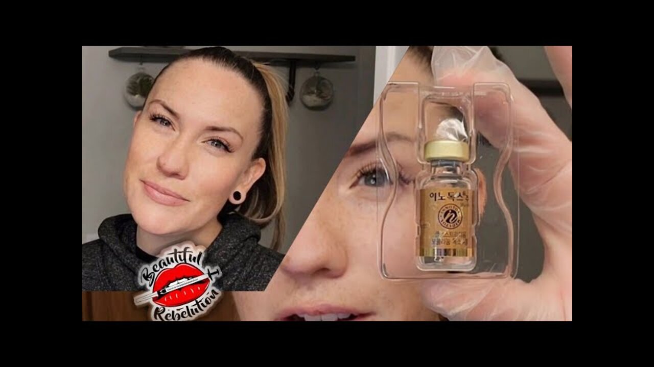 Bringing Back An Old Favorite | Freezing My Forehead