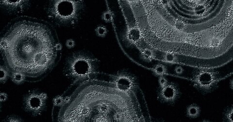 Graphene oxide is the real cause of CV symptoms