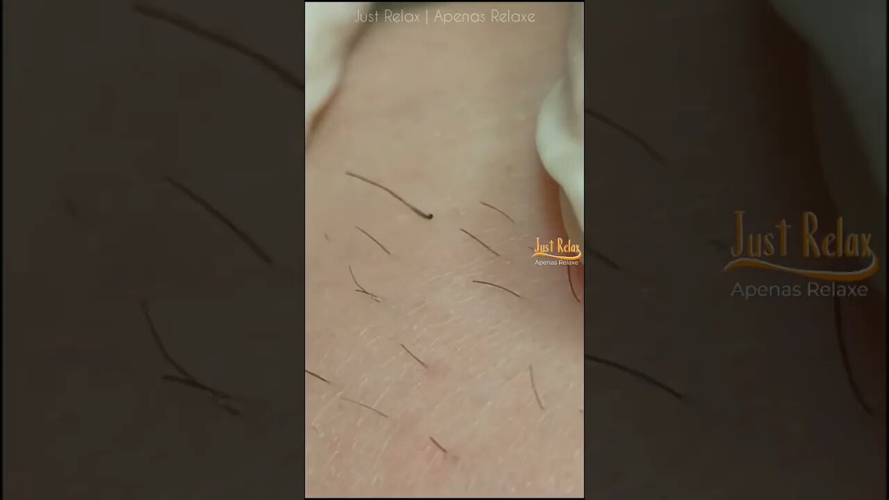 Vídeo Satisfatório Eletrólise Depilação Elétrica Definitiva 2 - Relaxing and Satisfying Electrolysis