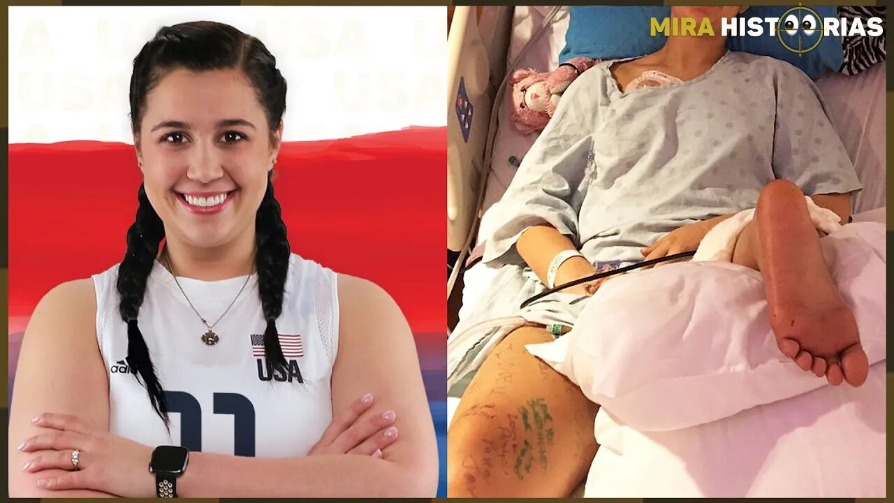 Lembra da jogadora de vôlei que optou por cortar as pernas? Ninguém esperava pelo que aconteceria