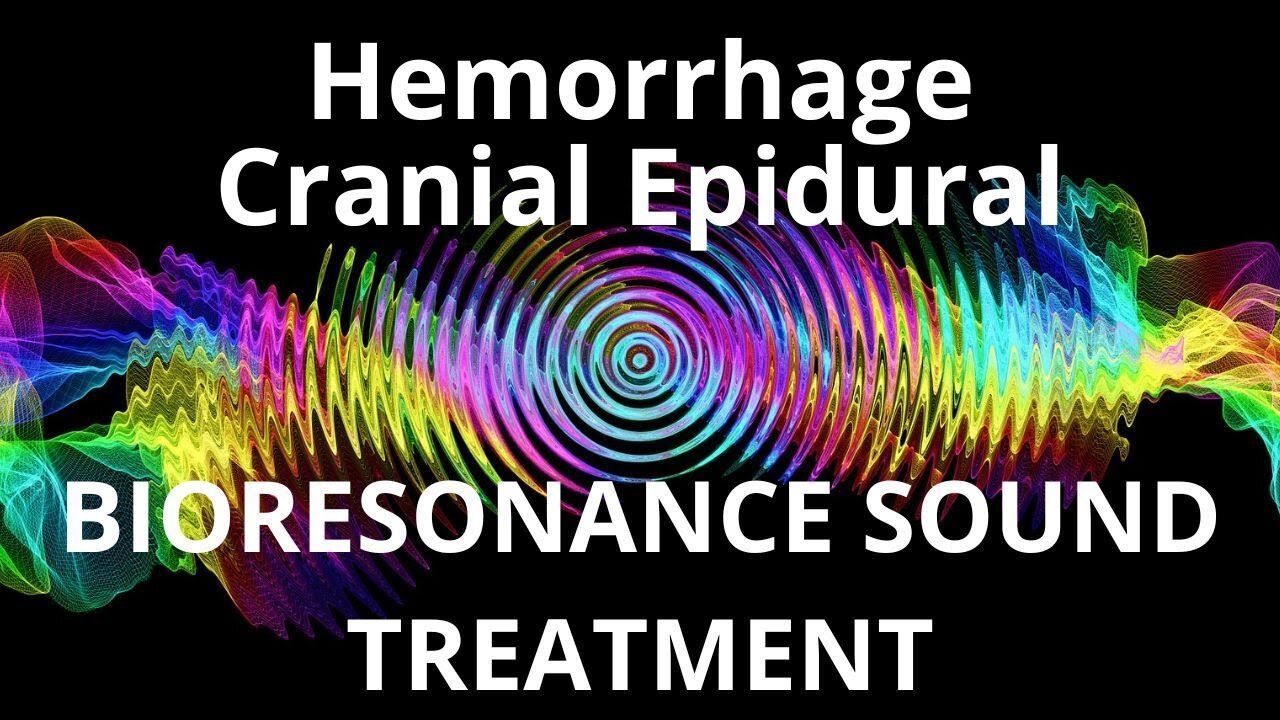 Hemorrhage Cranial Epidural _ Sound therapy session _ Sounds of nature