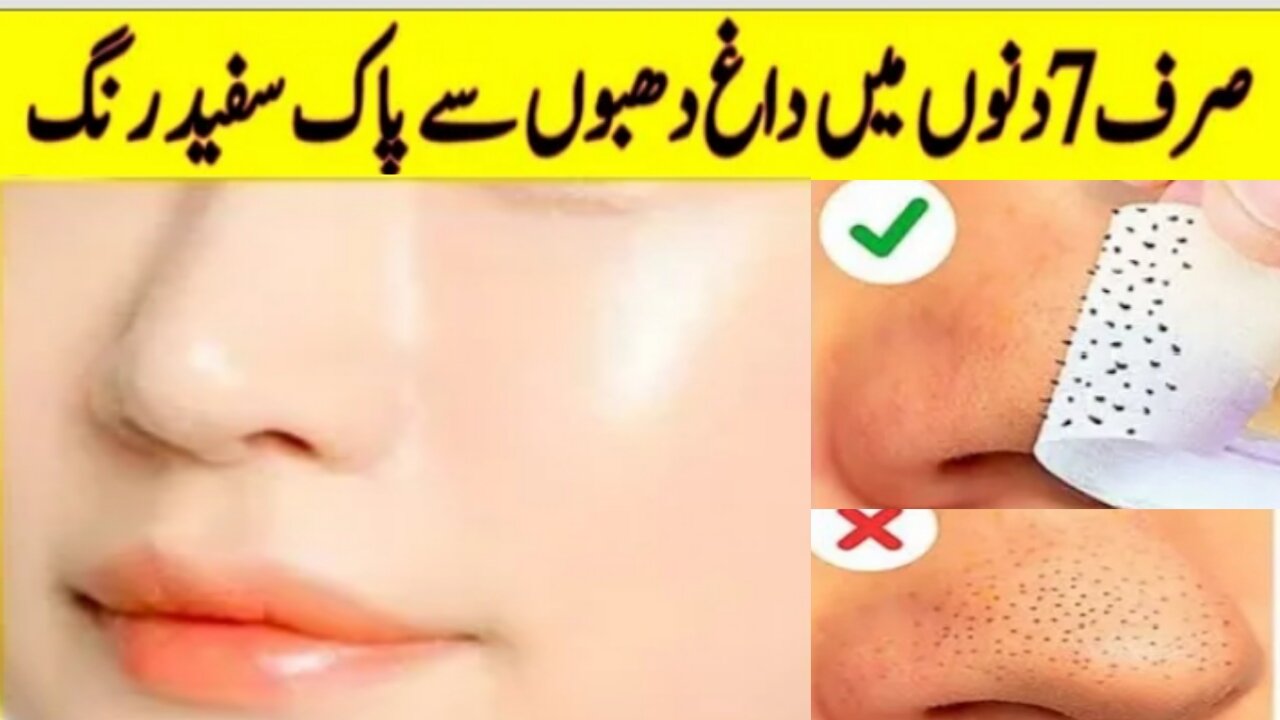 Dark Spots On Face Removal At Home | Make Dark Spots Removal Cream In Very Easy Way | Sajid TV 7013