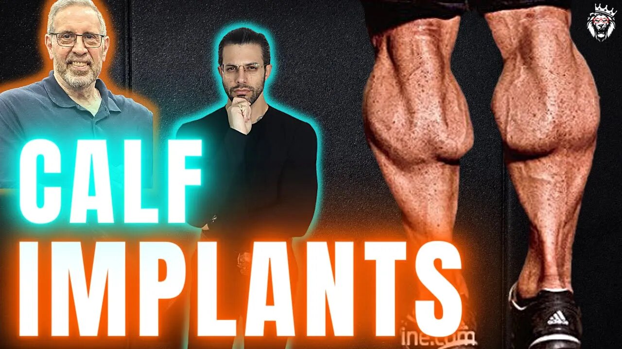 Calf Implants in Bodybuilding - More Common Than We Thought?