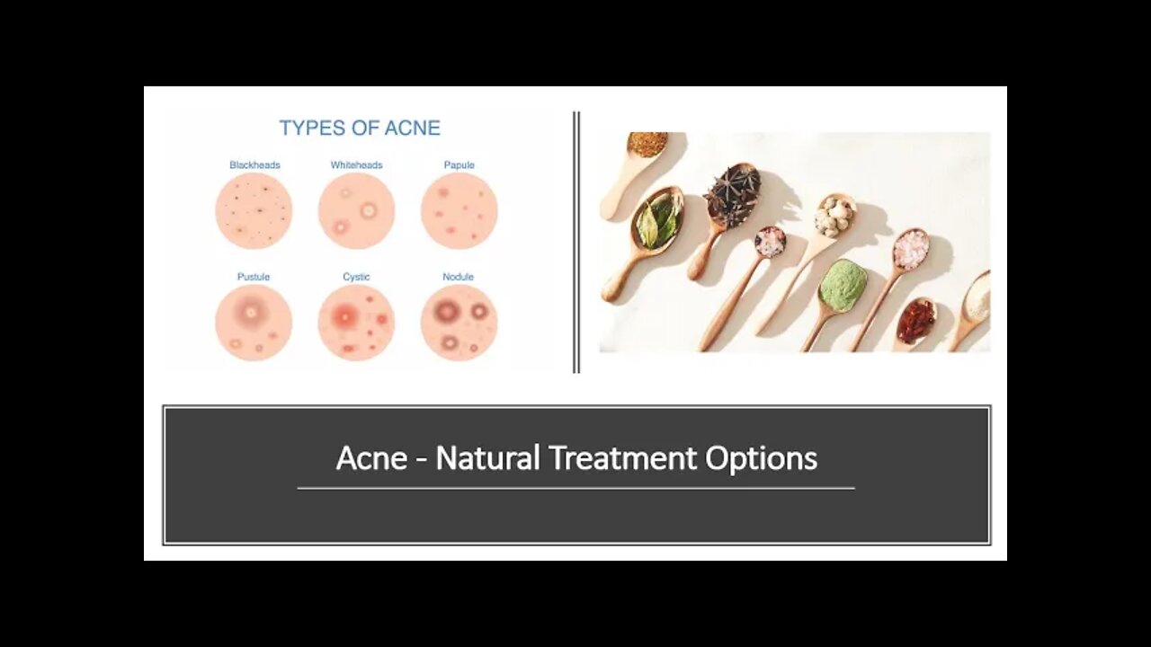 Acne Natural Treatment with Herbs & Supplements