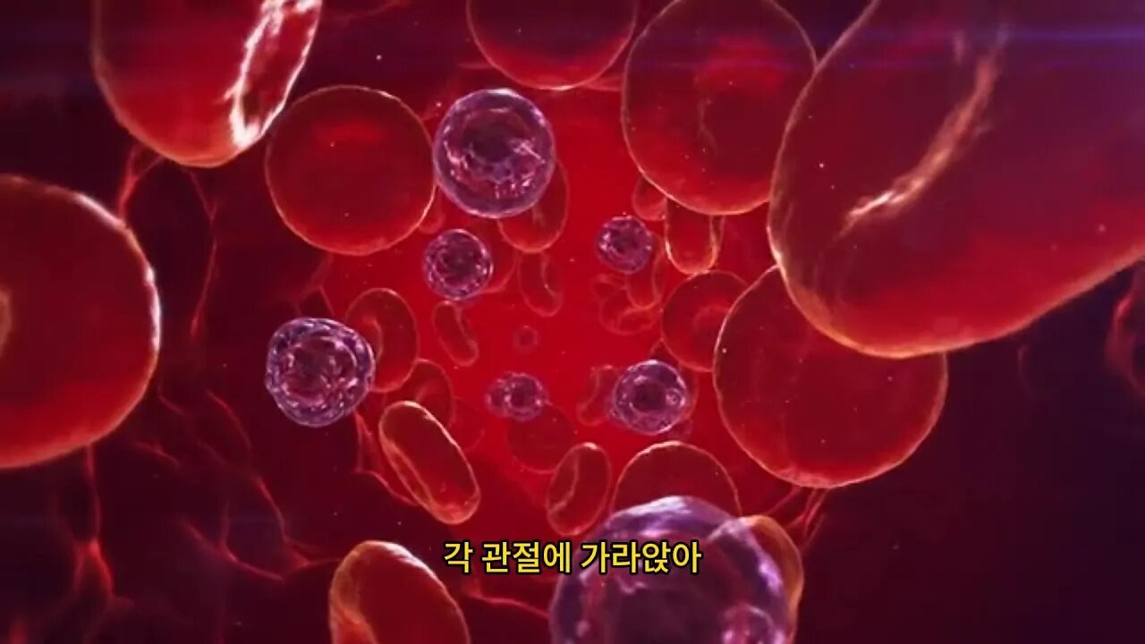 뇨산이 높은 사람은 2 황색을 적게 먹고 3 습을 없애며 4가지 일을 자주 하면 뇨산이 말