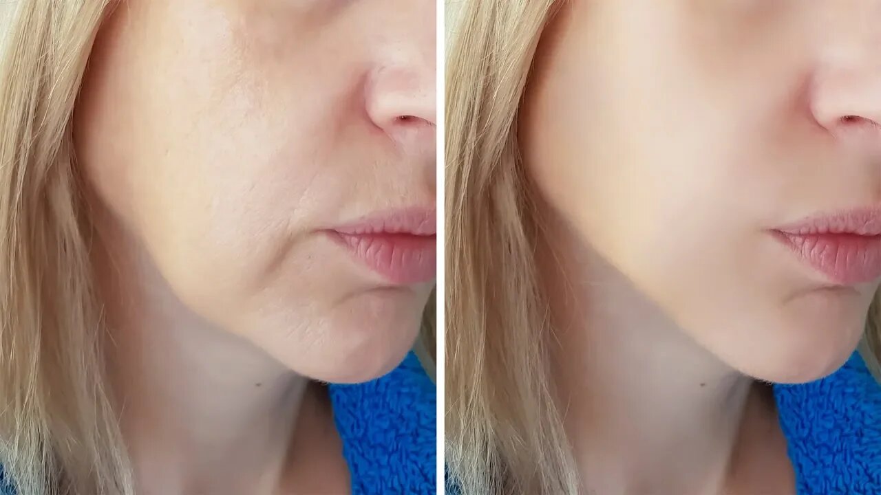 7 Foods That Make You Look Younger (Anti-Aging Foods)