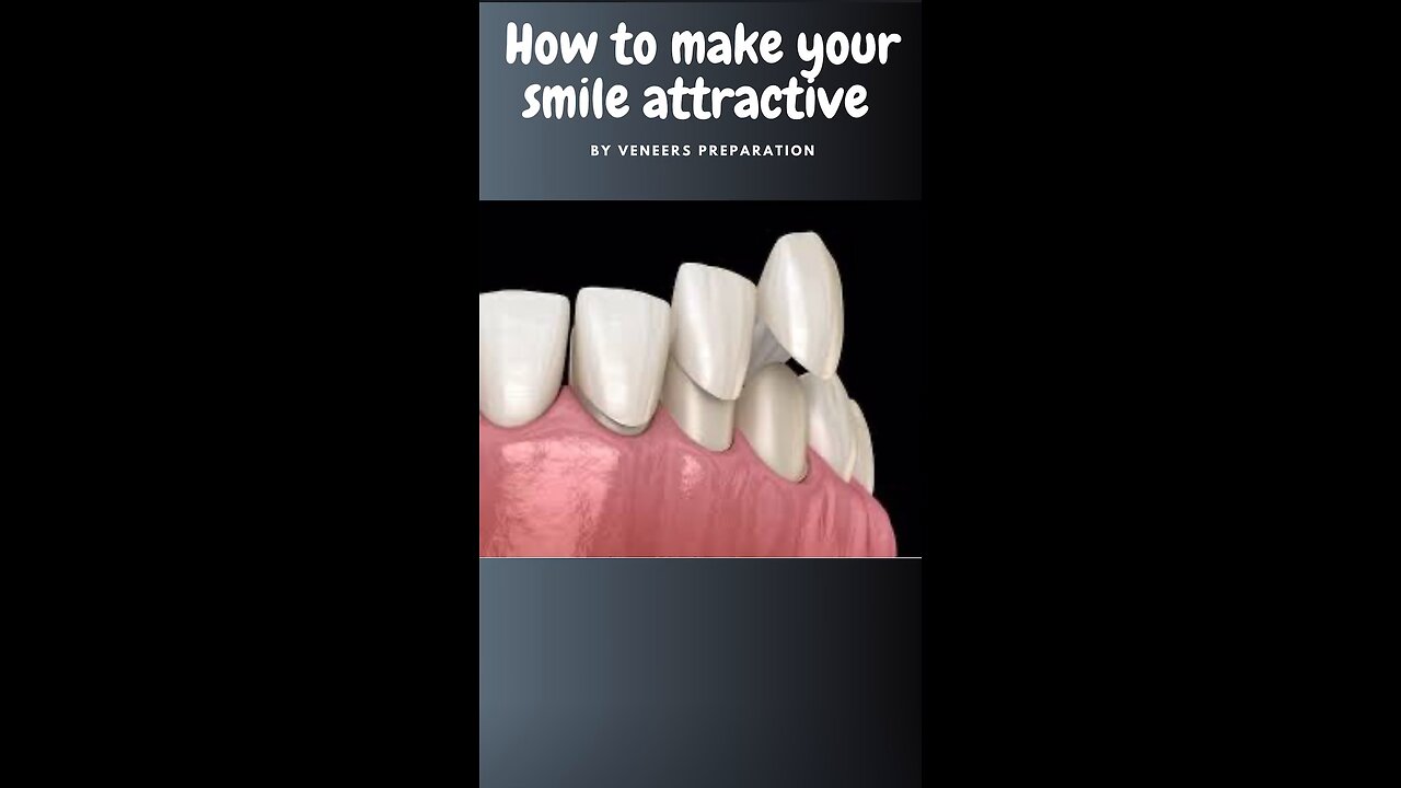 How to make your smile attractive | #dentalveneers#dentaltreatment