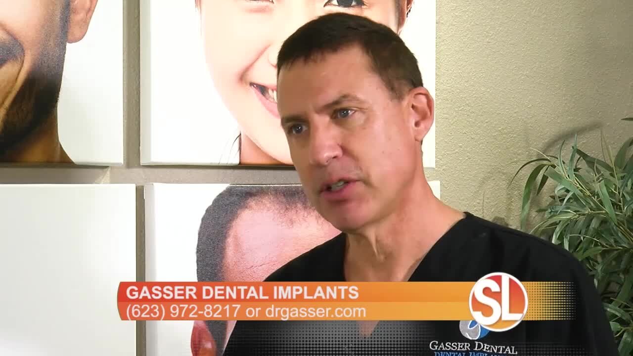 Gasser Dental Implants: All you need to know about the dental ​implant process