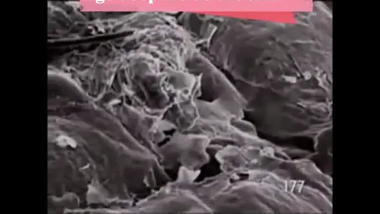 Microscopic view of the skin tiktok biopsychosociale