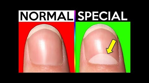 10 Signs You're Actually Normal