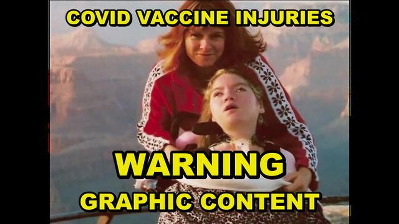 COVID VACCINE INJURIES - WARNING ( GRAPHIC CONTENT ) - SHARE THIS TO INFORM PEOPLE WHAT MAY HAPPEN