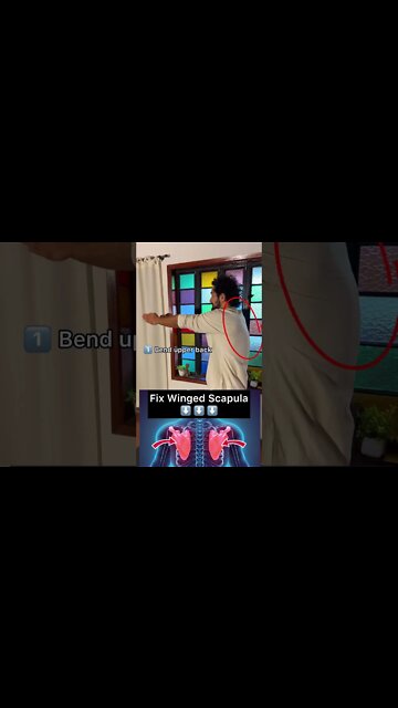 Do This If You Have A Winged Scapula
