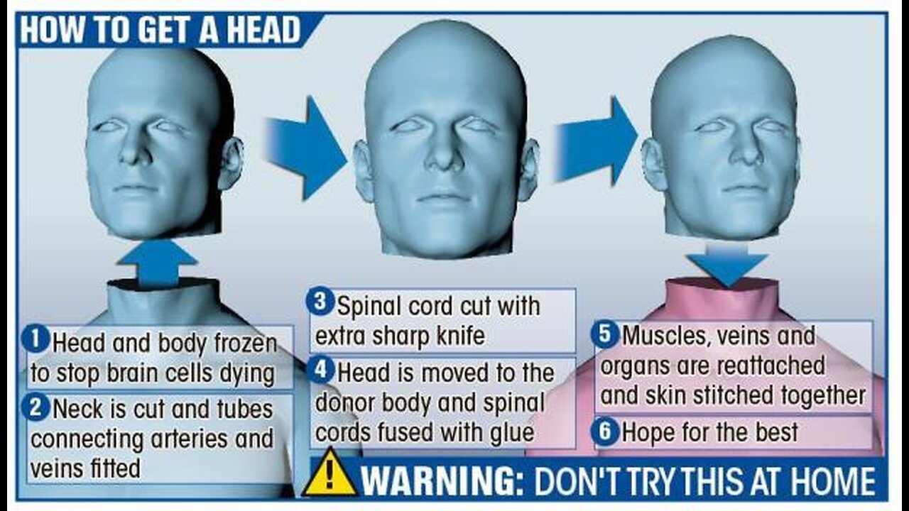 Full Head Transplants " Take on a new body" - Perfected In 2024