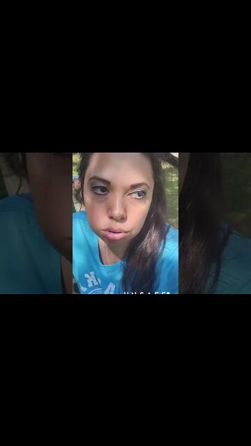 Lemongrabs Love Chewing Hair