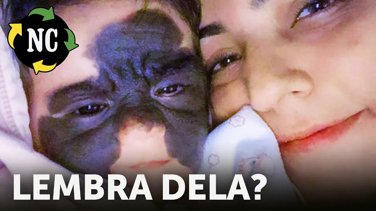 Lembra da filha deste casal com uma enorme mancha no rosto? Uma rápida mudança confortou à família